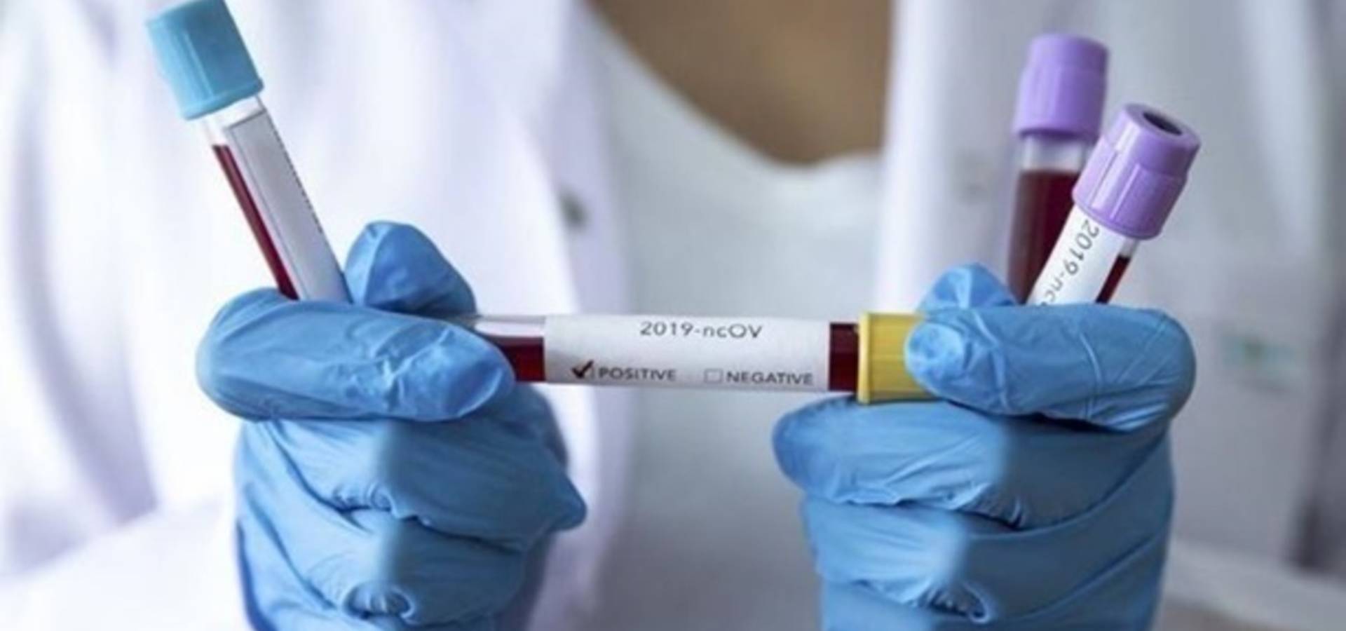Коронавірус вже в Україні
