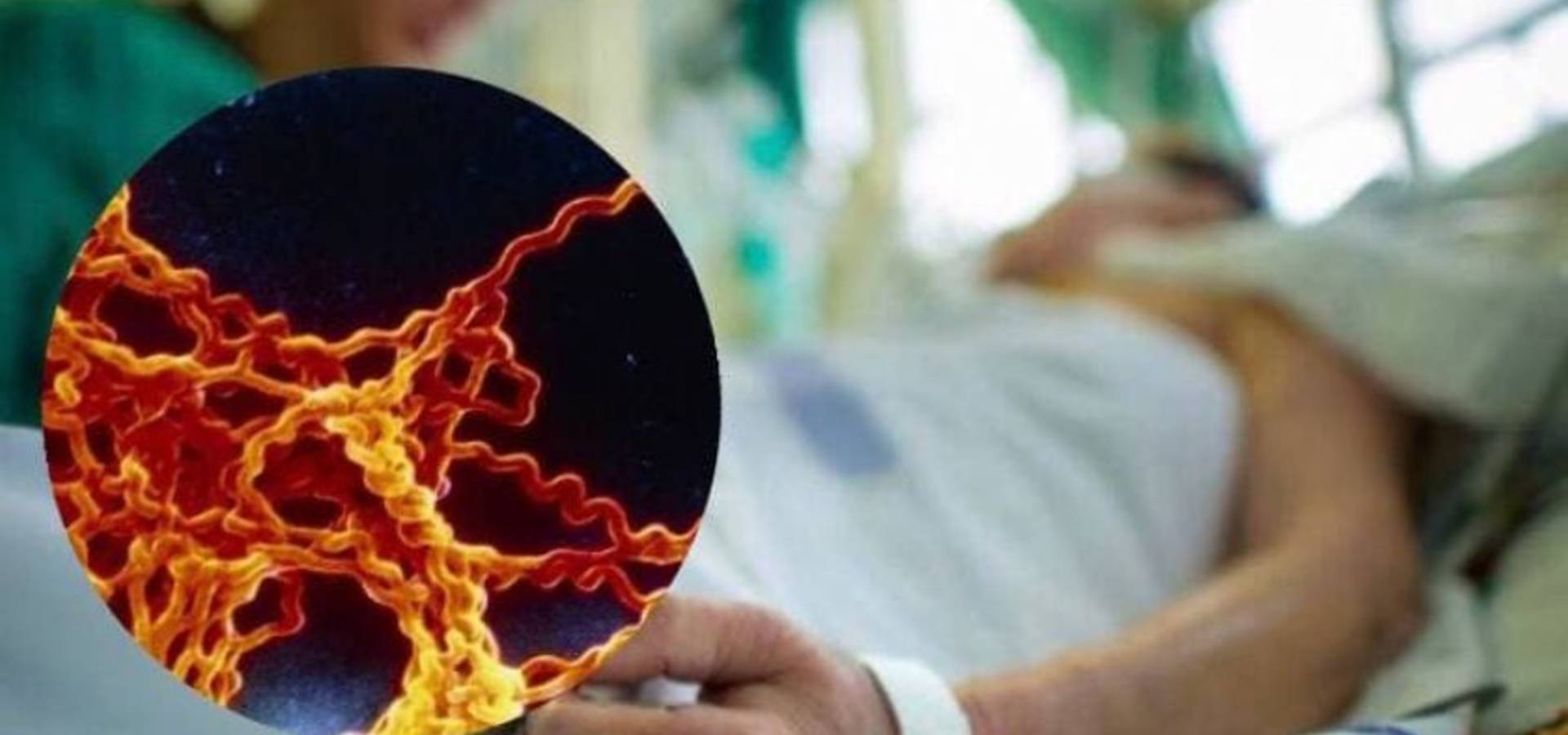 В Хмільницькому районі на Вінниччині було виявлено 5 випадків лептостерозу, 1 з них летальний