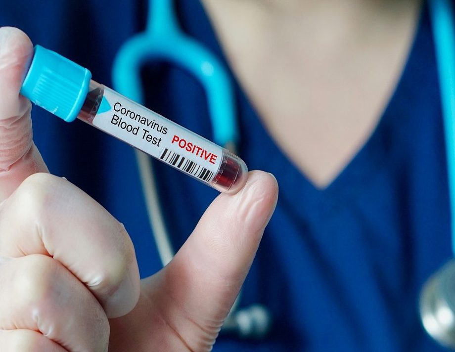 В Хмільницькому районі за добу зафіксовано 9 нових випадків захворювання на COVID-19