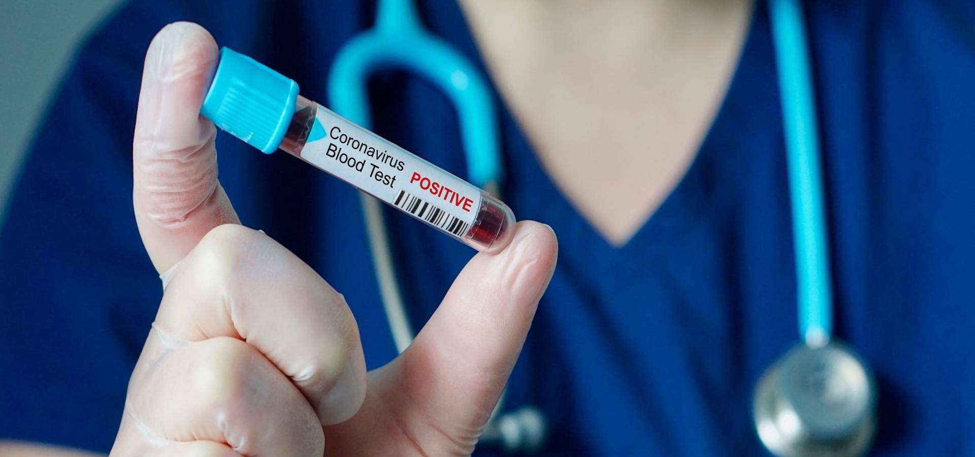 В Хмільницькому районі за добу зафіксовано 9 нових випадків захворювання на COVID-19