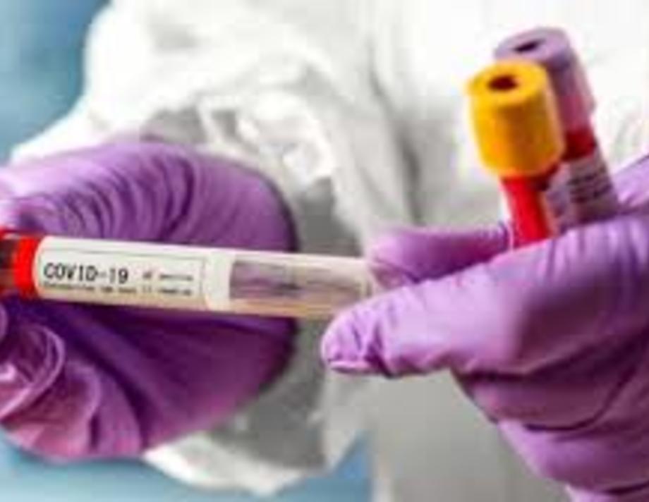 Скільки людей захворіли на COVID-19 в Хмільницькому районі за тиждень
