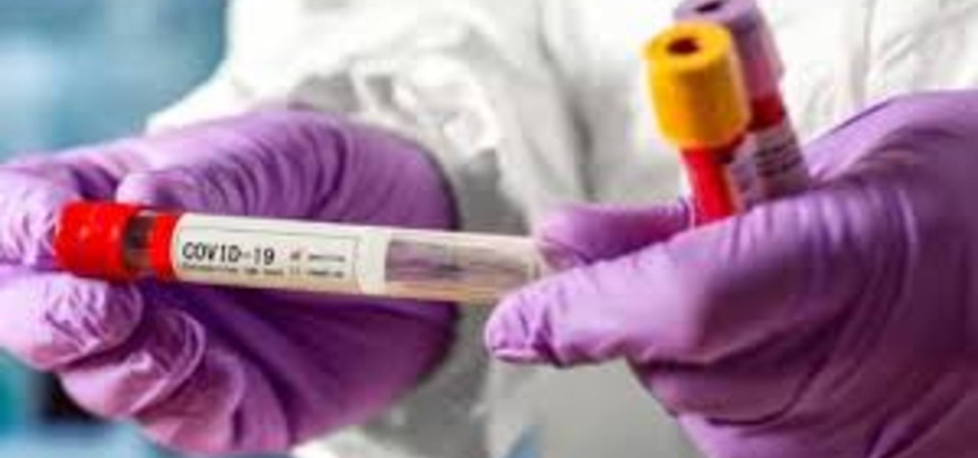 Скільки людей захворіли на COVID-19 в Хмільницькому районі за тиждень