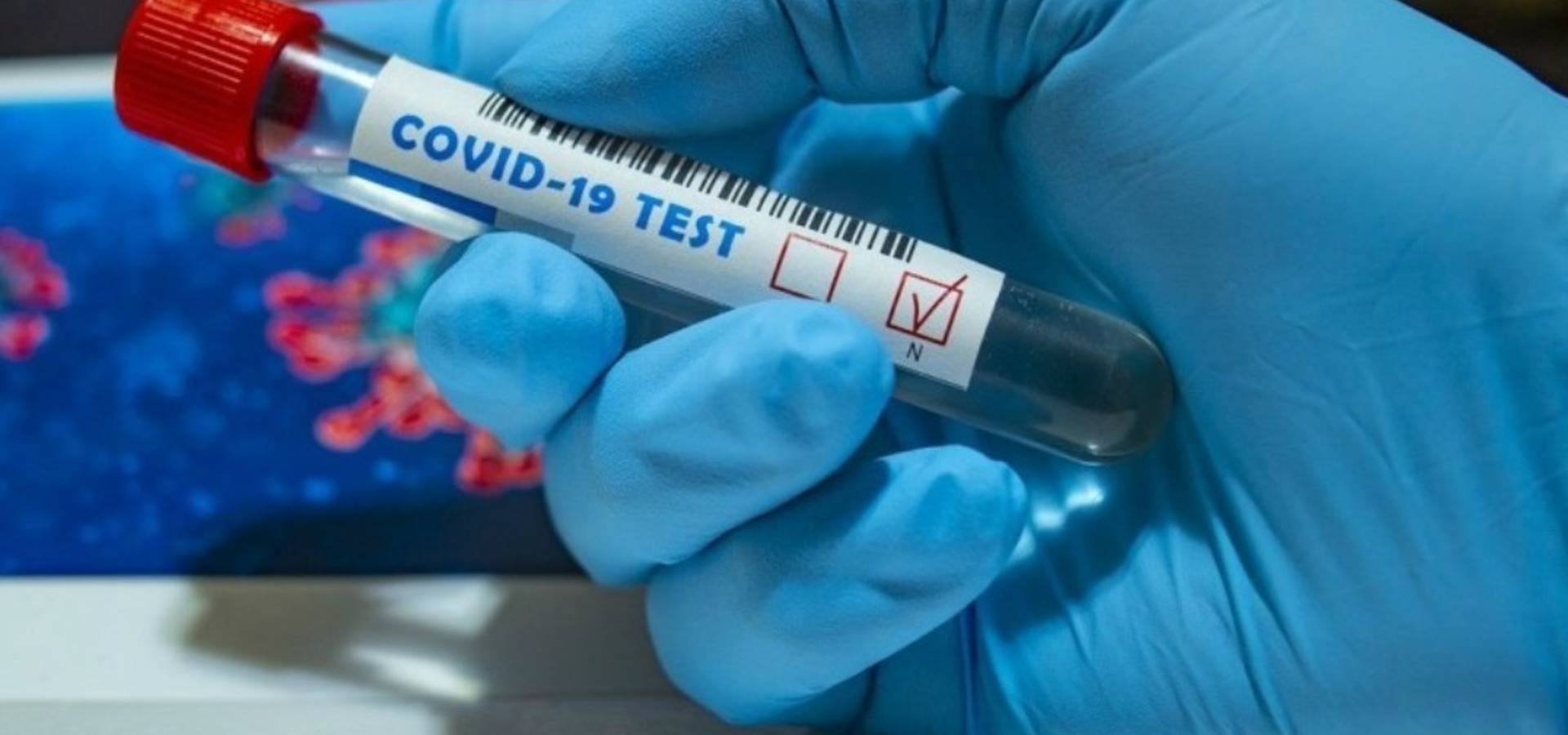 176 нових хворих на COVID-19 виявили в Хмільницькому районі за дві доби