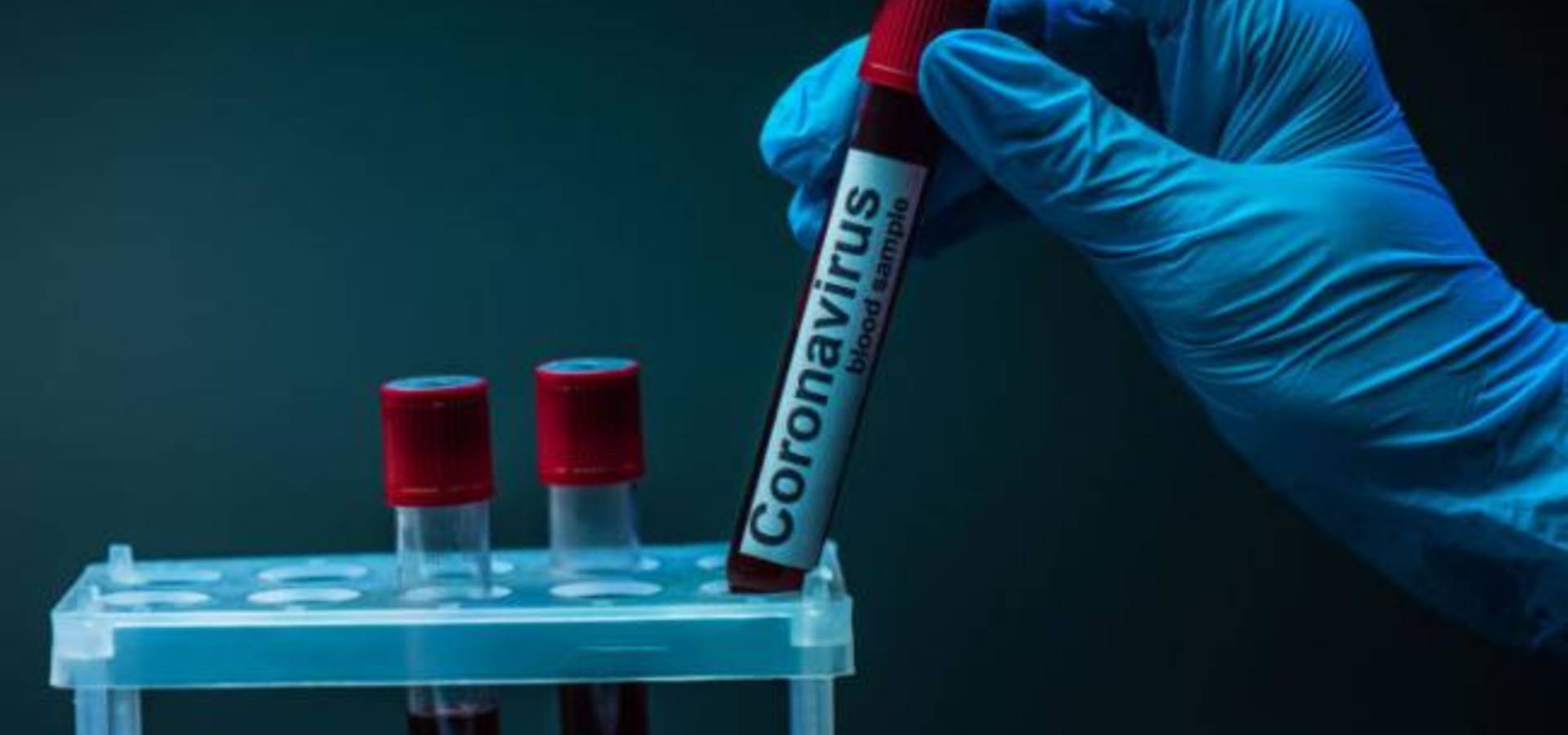 Скільки людей захворіли на COVID-19 у Хмільницькій, Війтівецькій та Уланівській громадах за тиждень