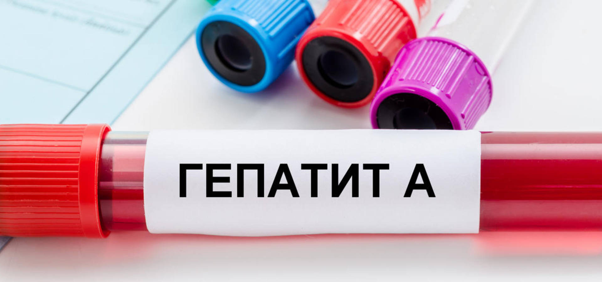 У Хмільницькому районі зареєстрували перший випадок гепатиту А