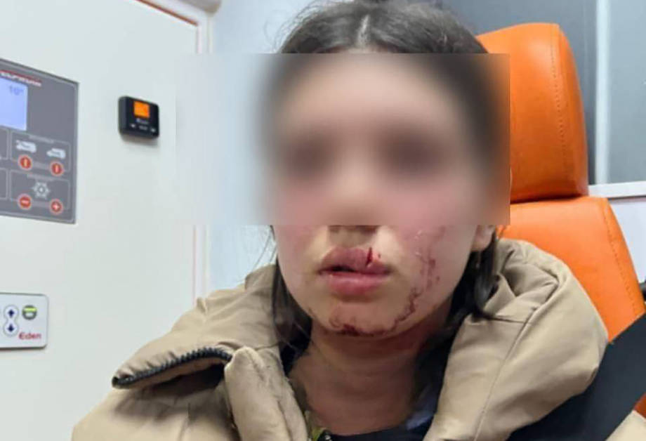 В Хмільницькому районі малолітній хлопчина камінцем покалічив 13-річну дівчинку