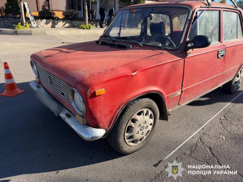 У Хмільнику автомобіль збив 4-річного хлопчика: дитину госпіталізували